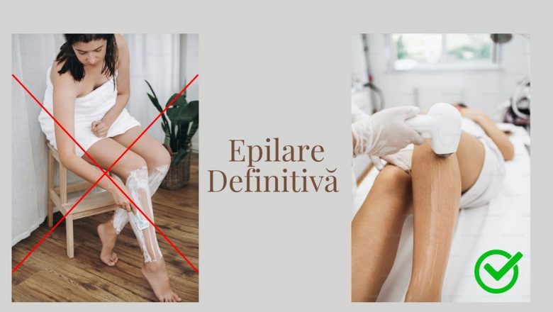 Epilarea Definitivă cu Laser: O Soluție Eficientă și Sigură pentru Părul Nedorit