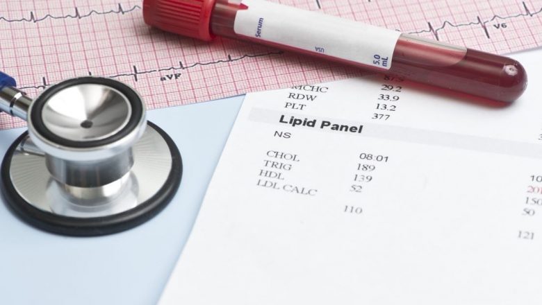 Analizele de sânge care dezvăluie riscurile de infarct: Ghidul complet al sănătății cardiovasculare