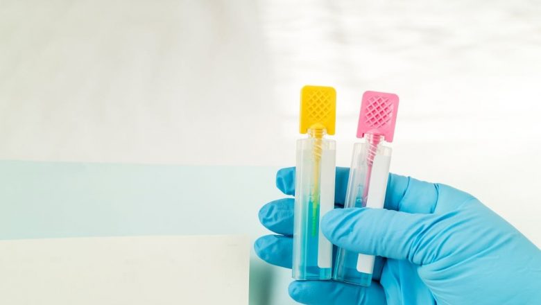 Testul imunochimic fecal: O abordare eficientă în depistarea cancerului colorectal la domiciliu
