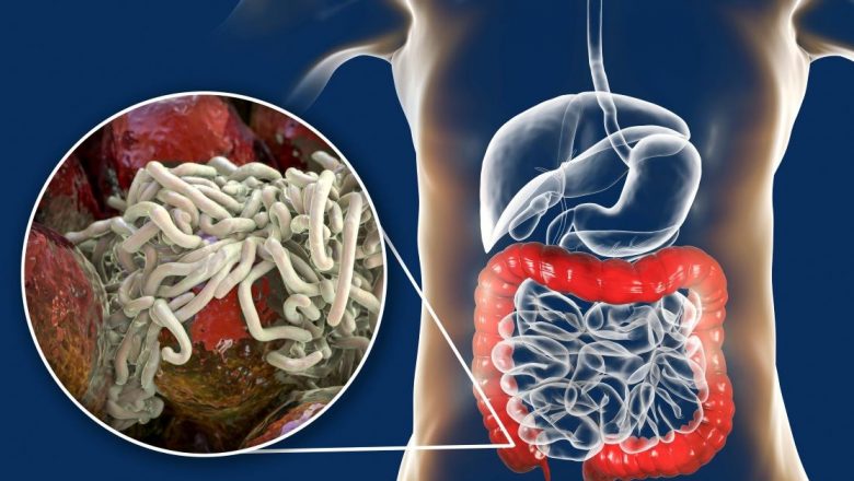 Semnele Infecției cu Paraziți Intestinali și Remedii Naturale Eficiente