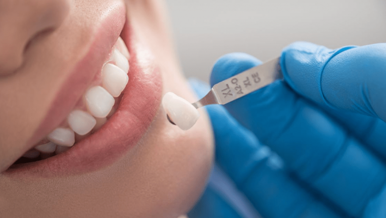 Coroanele dentare: Durabilitate, tipuri și importanța unei îngrijiri corecte
