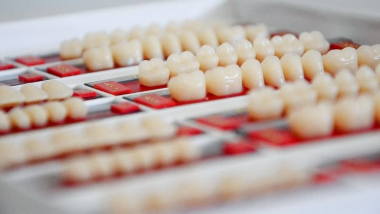 Fațetele dentare: Avantaje, riscuri și impactul asupra sănătății dentare