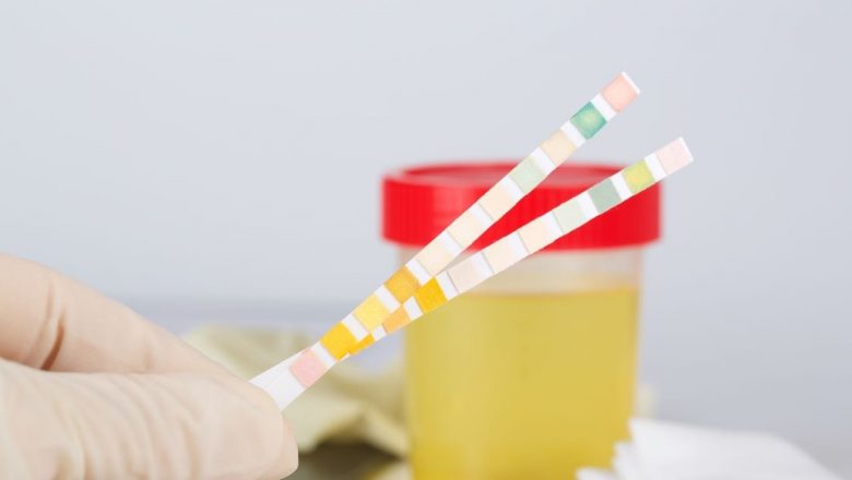 Importanța pH-ului Corpului: Impactul Dezechilibrelor Acido-Bazice asupra Sănătății