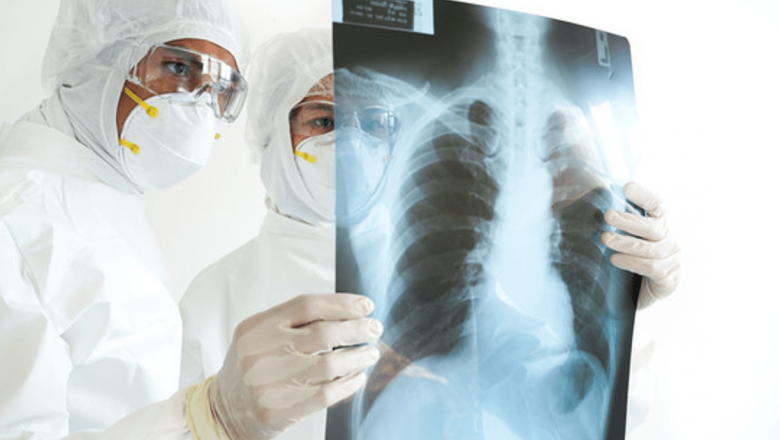 Riscurile iradierii în procedurile de radiologie și imagistică medicală: o analiză detaliată