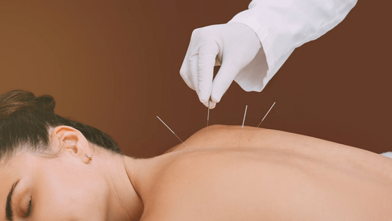 Acupunctura: O Analiză Detaliată a Eficienței și Beneficiilor Sale în Medicina Modernă