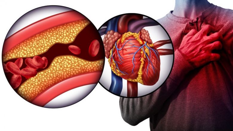 Impactul Colesterolului Ridicat Asupra Sănătății: Riscuri și Măsuri de Prevenire
