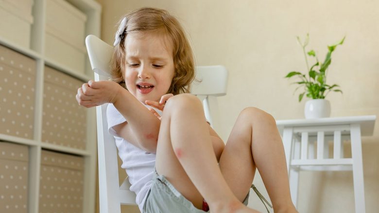 Cum să tratezi înțepăturile de insecte: Remedii eficiente și perspective asupra impactului lor