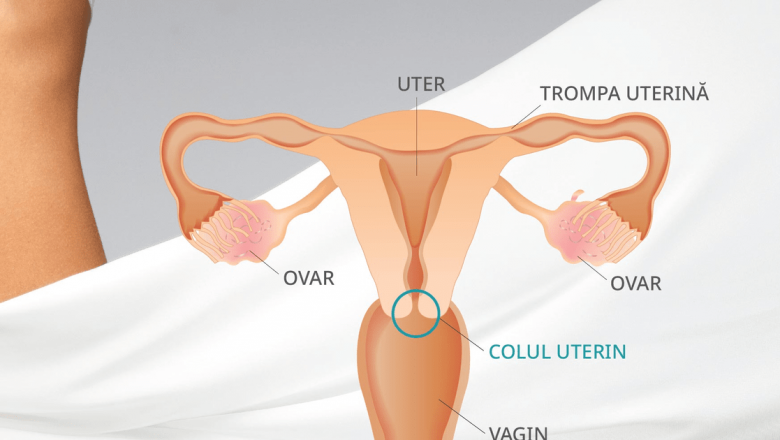 Cancerul de col uterin: o provocare de sănătate publică și soluții eficiente pentru prevenire
