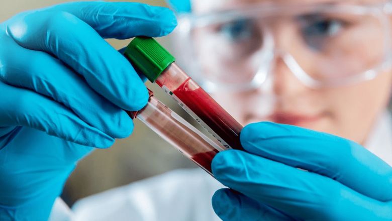 Leucemia și Limfomul: Semne, Simptome și Tratament – Un Ghid Complet
