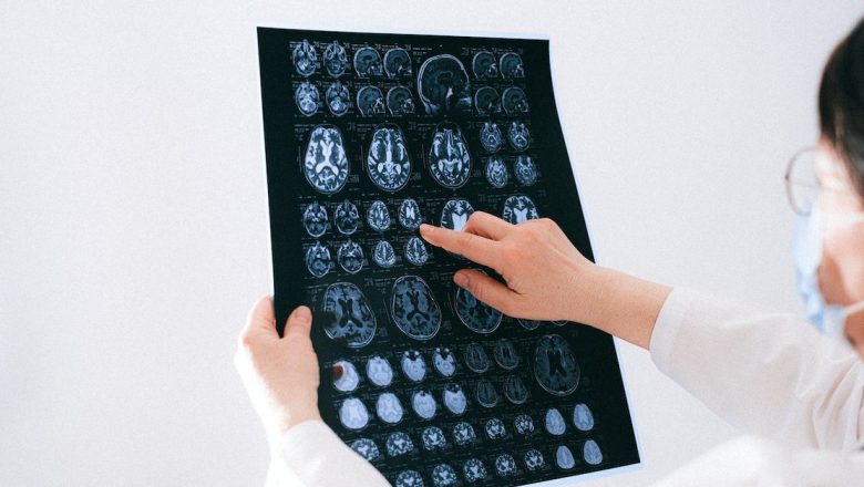 Câți ani are creierul tău? Analiza impactului vârstei asupra memoriei și abilităților cognitive