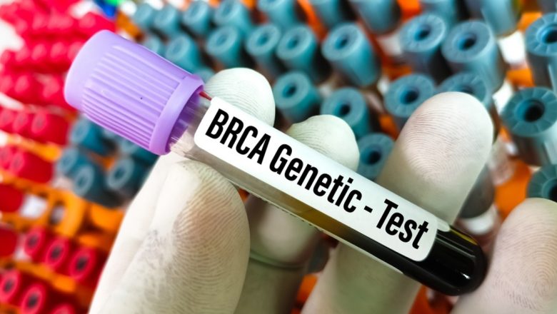 Transmiterea genetică a cancerului mamar: O analiza detaliată a riscurilor și opțiunilor de prevenire