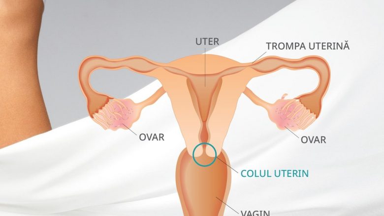 Cancerul de col uterin: O privire detaliată asupra cauzelor, riscurilor și prevenției