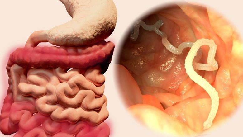 Teniaza: Parazitul Intestinal de 10 Metri și Impactul Său Asupra Sănătății Umane