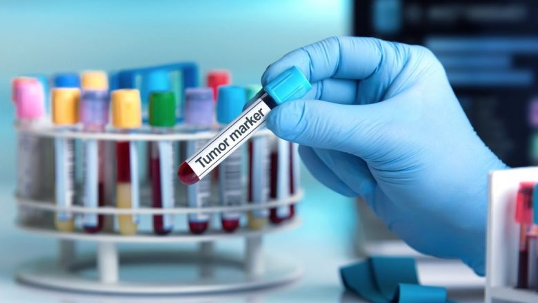 Markerii tumorali: Rolul lor în depistarea cancerului și implicațiile acestora în diagnosticare