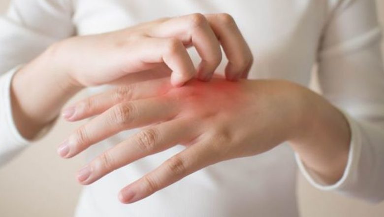 Mâncărimea pielii: semne, cauze și legătura cu cancerul