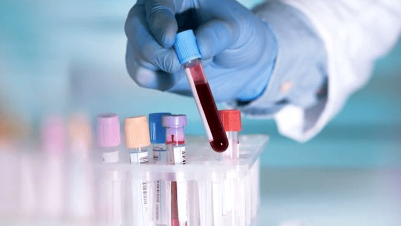 Importanța Testării Albuminei Serice: Diagnosticarea Boliilor Prin Analiza Sângelui