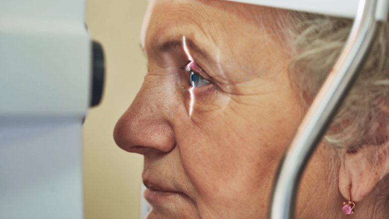Glaucomul: O privire detaliată asupra unei afecțiuni oftalmologice devastatoare