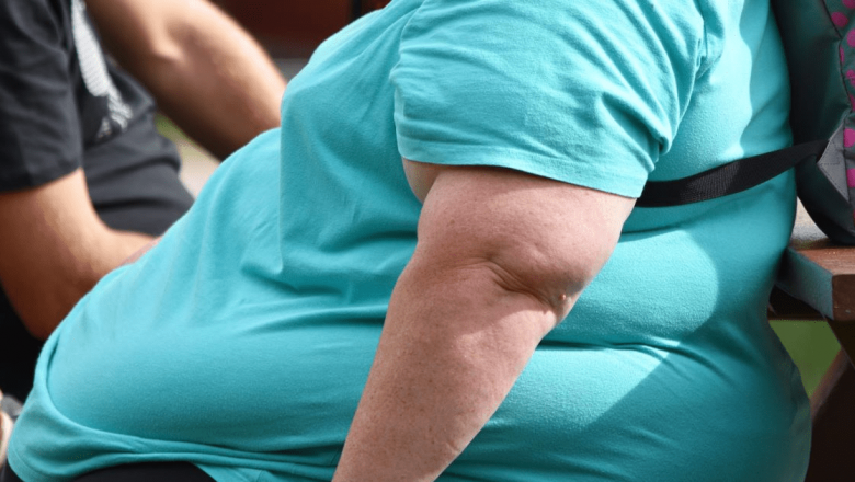 Transformarea unei vieți: Cum a reușit Mihaela să slăbească de la 216 kg la 70 kg prin intervenția chirurgicală