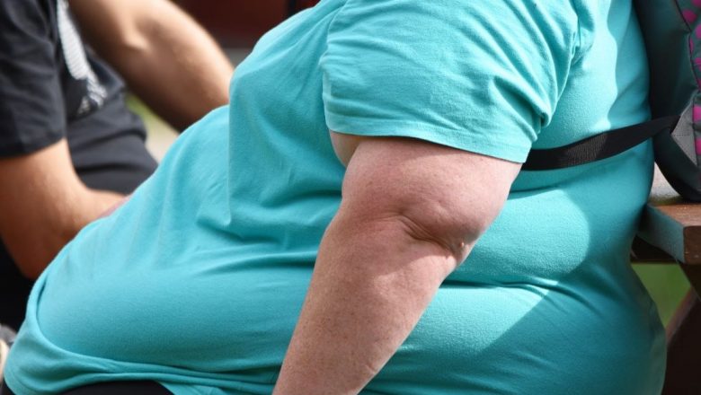 Transformarea Remarcabilă a Mihaelei: De la 216 kg la 70 kg prin Chirurgia Bariatrică
