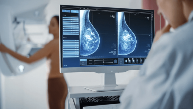 Revoluția în Tratamentul Cancerului Mamar: Tehnica de Radioterapie în Inspir Profund