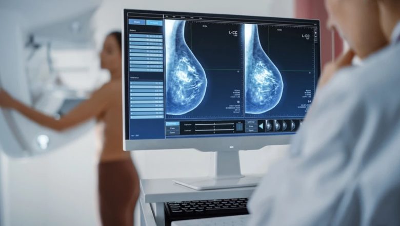 Inovație în Tratamentul Cancerului Mamar: Radioterapia în Inspir Profund și Tehnologia SGRT