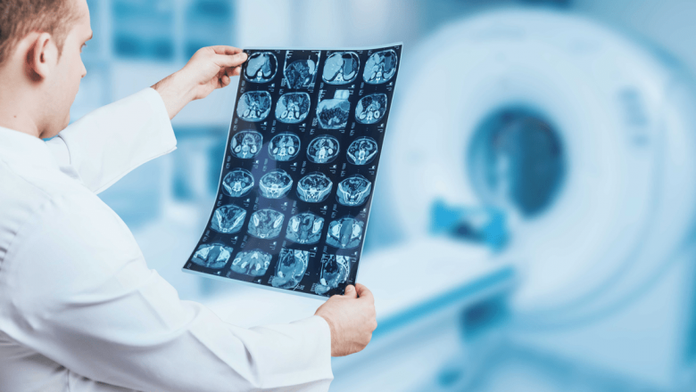 Importanța Evaluării Oncologice Multidisciplinare în Tratamentul Cancerului: O Abordare Integrată pentru Cele Mai Bune Rezultate