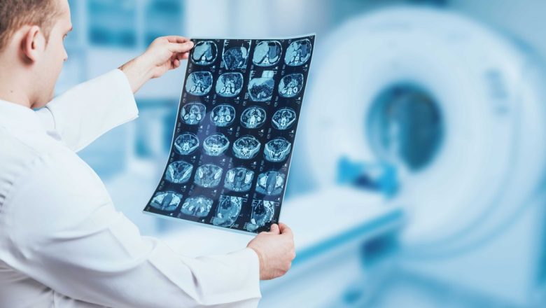 Evaluarea oncologică multidisciplinară: O abordare esențială pentru rezultate optime în lupta cu cancerul