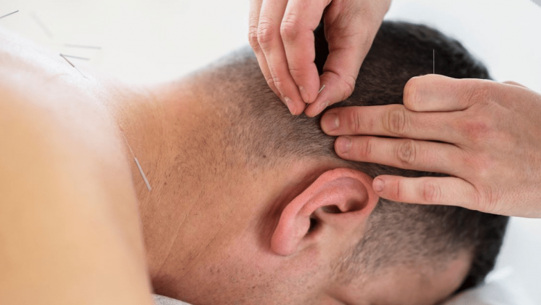 Acupunctura: O Perspectivă Detaliată asupra Practicii și Beneficiilor Sale pentru Români