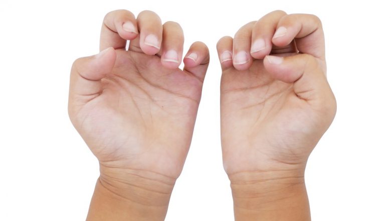 Semnele ascunse ale sănătății inimii: Cum unghiile pot dezvălui probleme cardiace grave