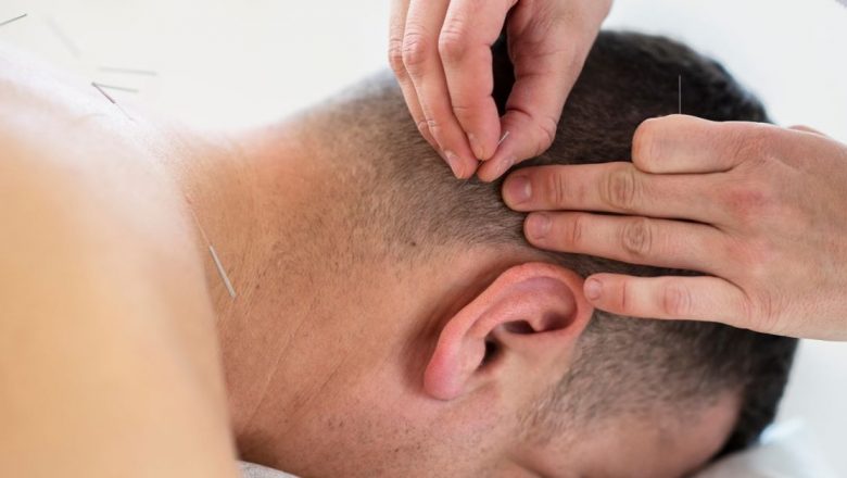 Acupunctura în România: O privire detaliată asupra practicii și beneficiilor sale