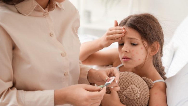 Scarlatina: Semne, tratament și creșterea incidenței în rândul copiilor