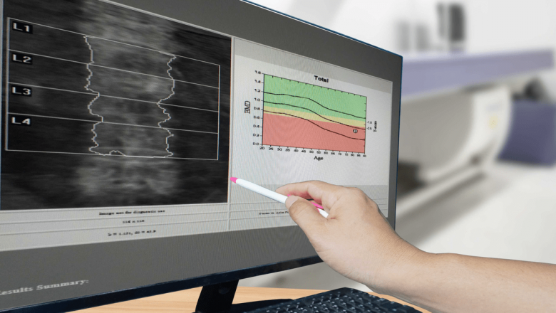 Importanța consultului medical în perioada menopauzei: o necesitate pentru sănătatea femeilor