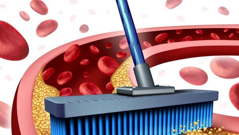 Colesterolul: Mituri, Fapte și Implicații pentru Sănătatea Cardiovasculară