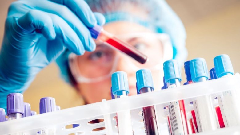 Importanța Hemoleucogramei: Un Test Esențial pentru Sănătatea Ta
