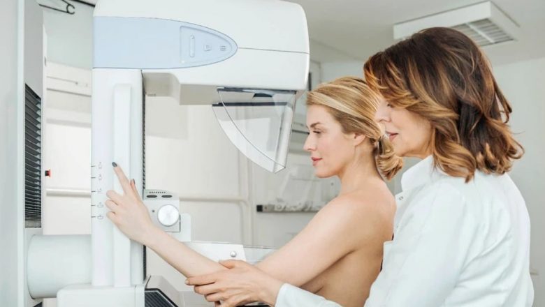 Mamografia: Mituri, Temeri și Importanța Depistării Timpurii a Cancerului de Sân