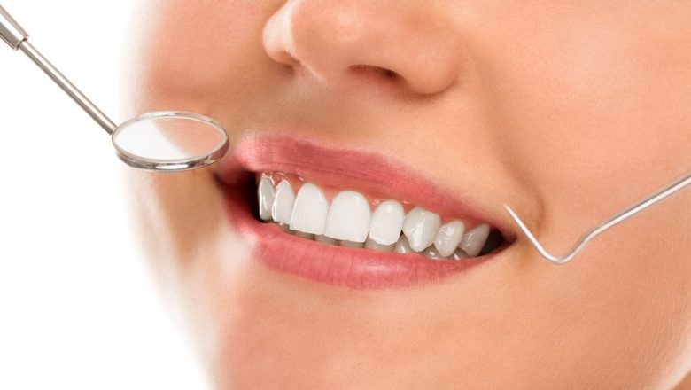 Reabilitarea Completă Dentară: O Soluție Complexă pentru Sănătatea Orală