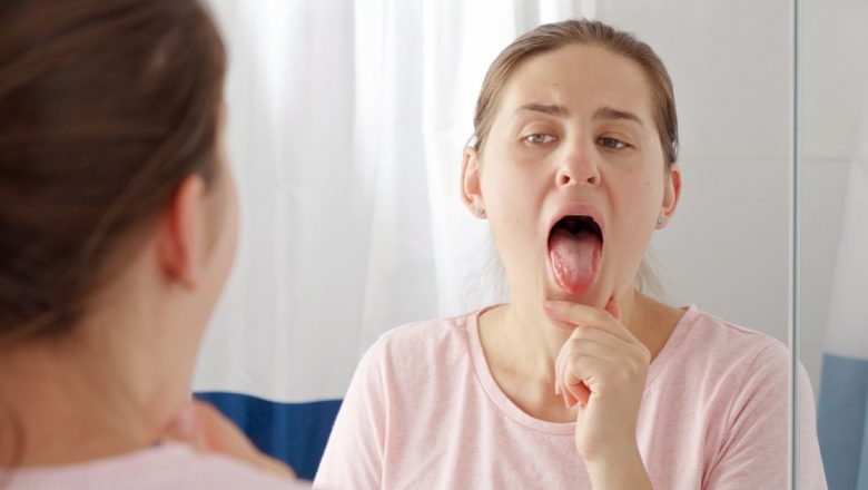 Arsurile pe Limbă: Cauze, Simptome, Tratament și Prevenție