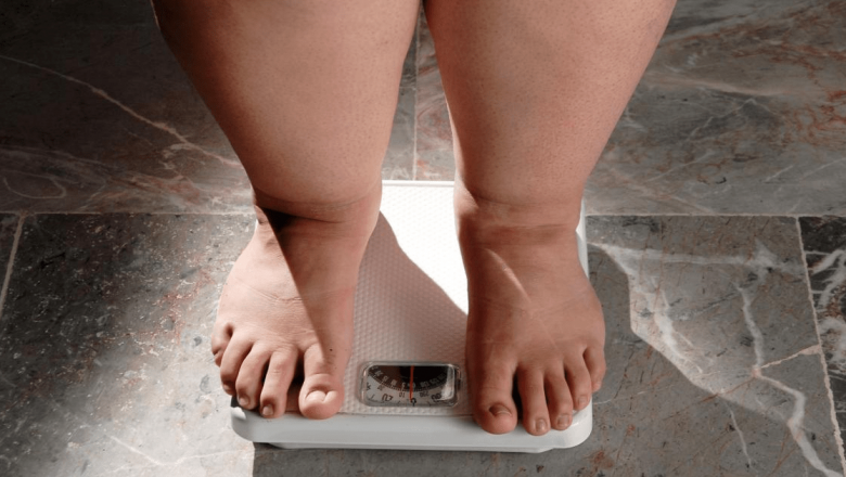 Lipoedemul: O Boală Subdiagnosticată și Impactul său Asupra Vieții Femeilor