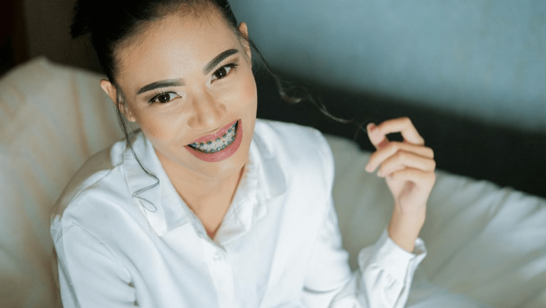 Rolurile esențiale ale aparatelor dentare: Beneficii imediate pentru sănătate și estetică