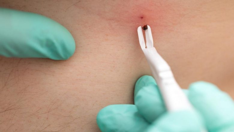 Ghid complet pentru îndepărtarea căpușelor: cum să te protejezi de riscurile infecțiilor transmisibile