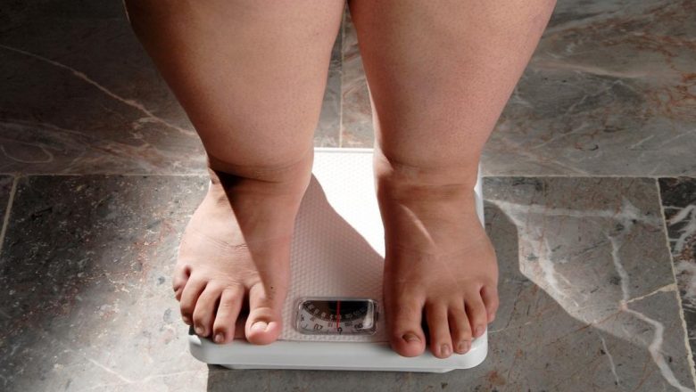 Lipoedemul: O Boală Subdiagnosticată și Impactul Său Asupra Vieții Femeilor