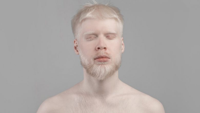 Pielea Palidă: Indicator al Posibilelor Afecțiuni Severe la Bărbați, Inclusiv Cancerul de Prostată