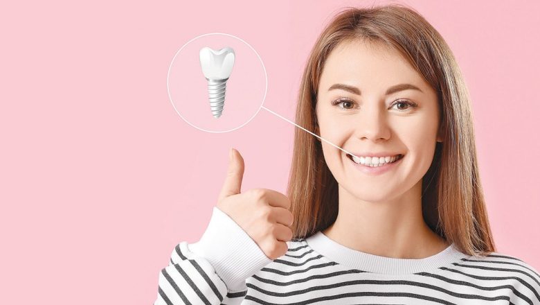 Implantul dentar: Tot ce trebuie să știi despre această soluție modernă pentru dinții lipsă