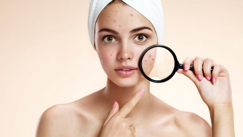 Lavanda: Soluția Naturală pentru Combaterea Acneei și Îngrijirea Tenului