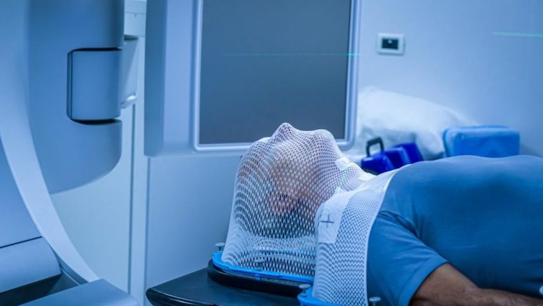 Radioterapia: O Analiză Detaliată a Tratamentului Cancerului și a Efectelor Sale