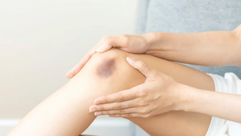 Arnica: Planta Minune pentru Tratarea Vânătăilor și Nu Numai