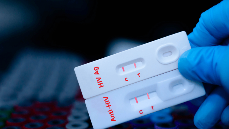 Riscurile Contractării HIV după o Singură Expunere: O Analiză Detaliată