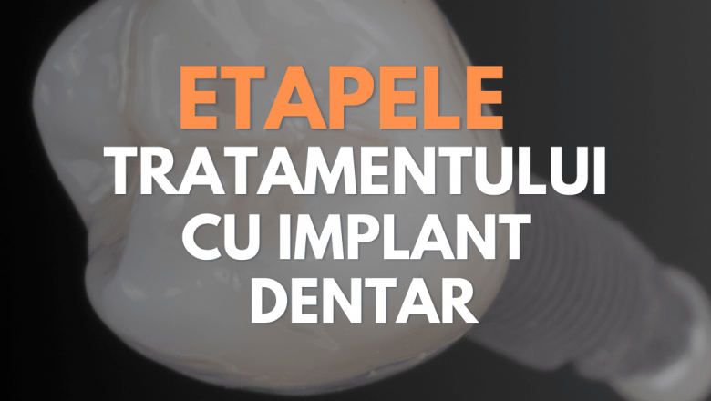 Etapele unui tratament cu implant dentar: O privire detaliată asupra soluțiilor moderne pentru restaurarea zâmbetului