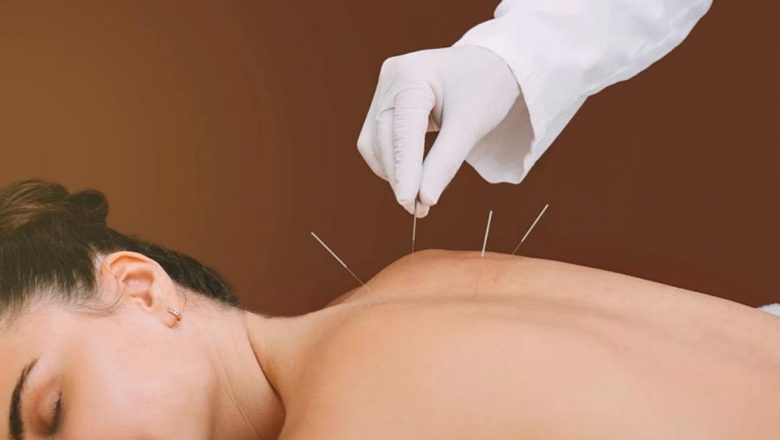Beneficiile Neștiute ale Acupuncturii: O Privire Detaliată Asupra Aceastei Terapiei Holistice
