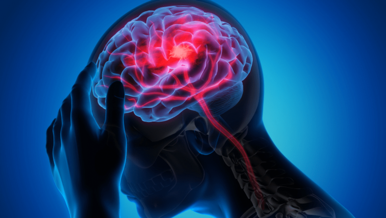 Importanța recunoașterii semnelor de accident vascular cerebral: Cum să acționezi rapid și eficient